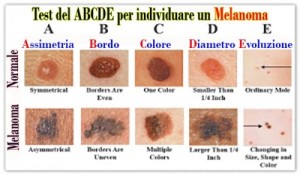 tumore-della-pelle-come-individuarlo-con-test-abcde