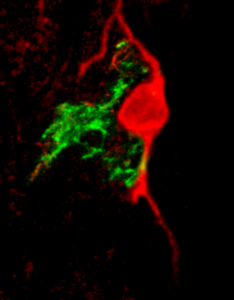 Neurone dopaminergico_cellula neurostaminale