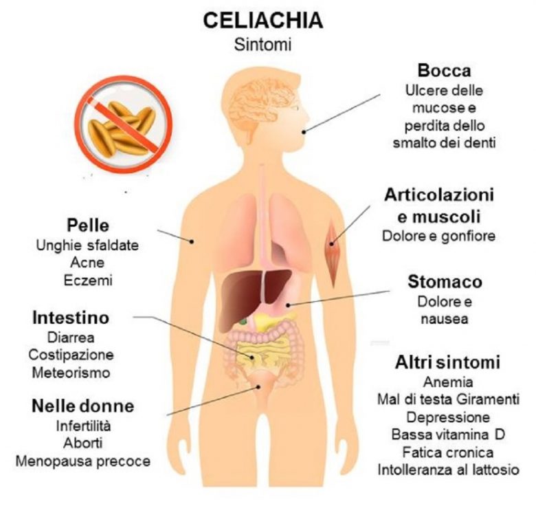 Celiachia-foto-tratta-da-Google-780x736